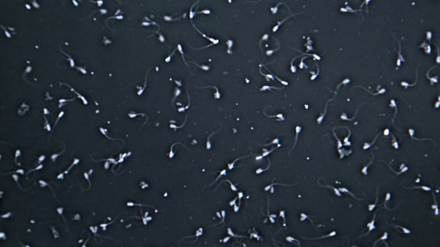 spermatozoides_microscope__024052600_1825_03072018__074006600_1647_24072018